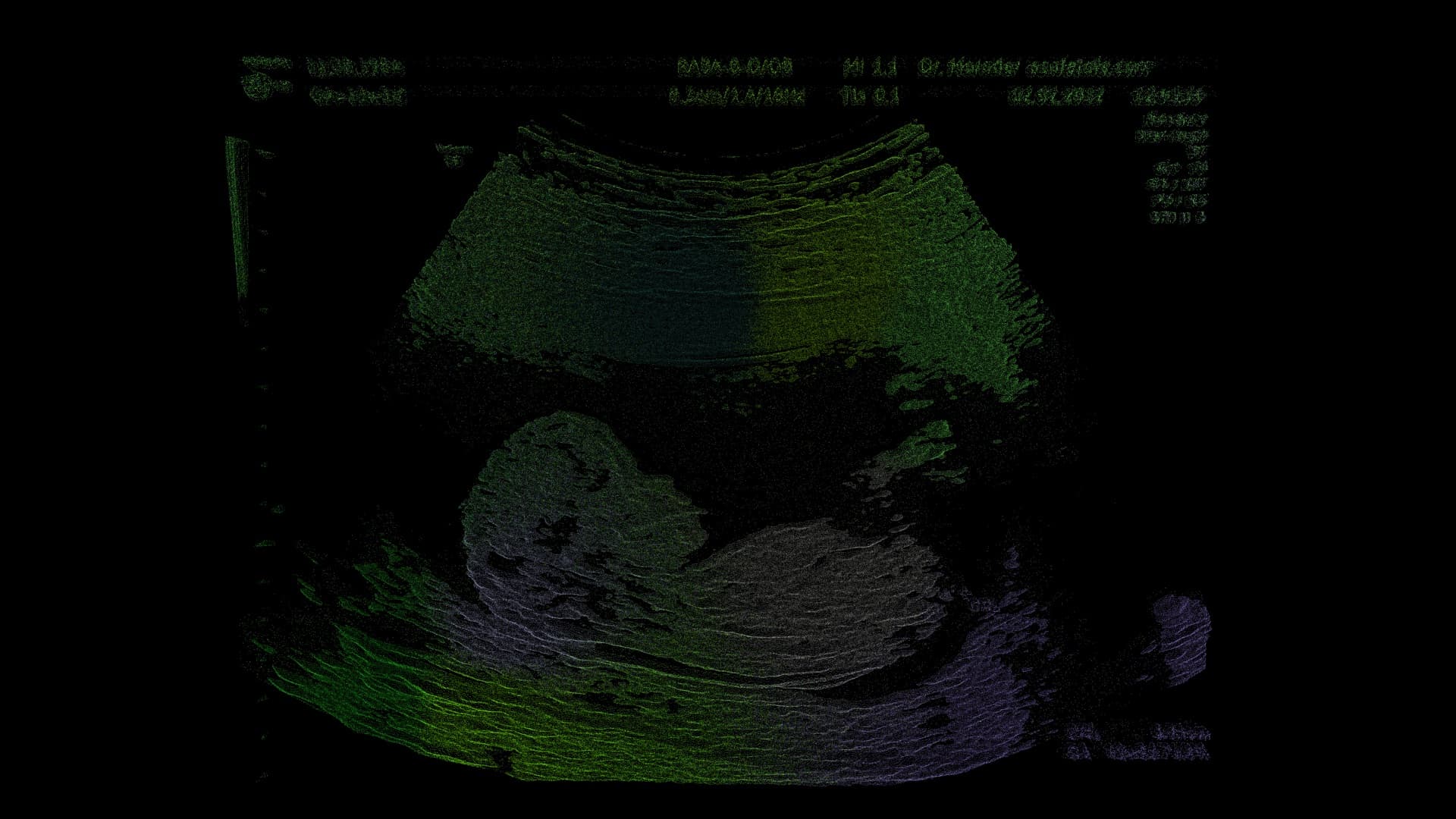 Echo Couleur — Arsentis