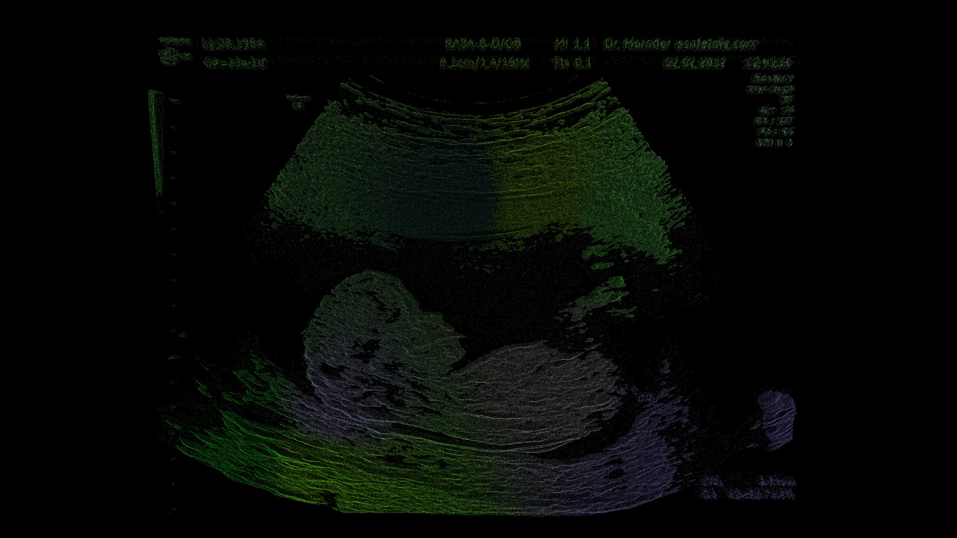 Écho Couleur: an ultrasound scan recoloured in green and violet, a body made visible by sound rather than by light